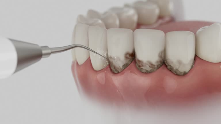 Trusted Teeth Cleaning And Checkup service in New Berlinville, PA - Dentist Open Now